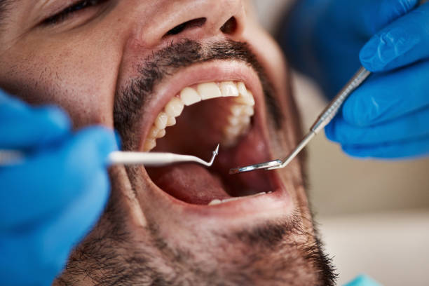 Best Same-Day Emergency Dentist in Farmersville, OH