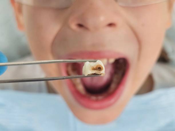 Best Pediatric Emergency Dentist in Farmersville, OH